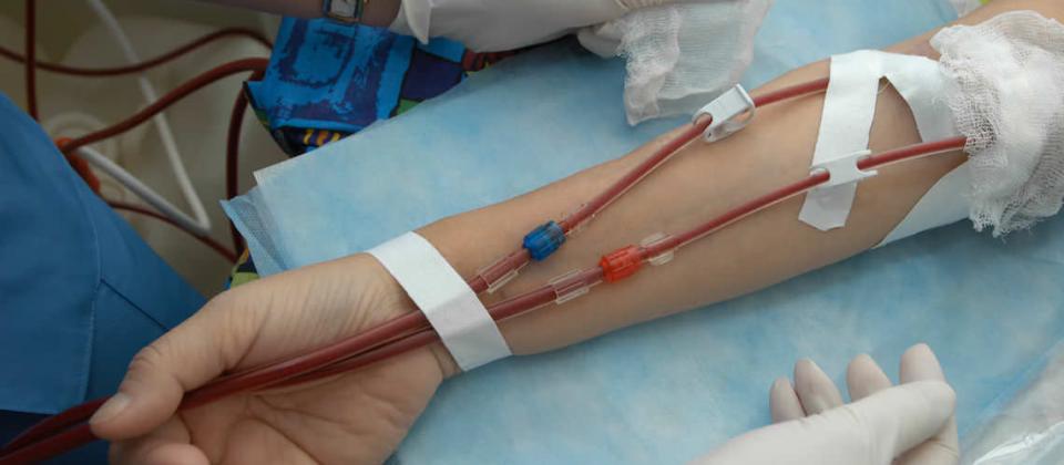 Patient receiving dialysis treatment — medical devices market